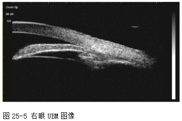 ZY016_130_5.gif
